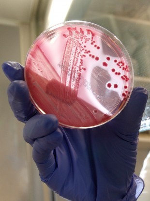 An employee at Hamburg hospital shows a culture of the EHEC bacterium. It's reported that 300 people have fallen sick with the rare complication HUS.