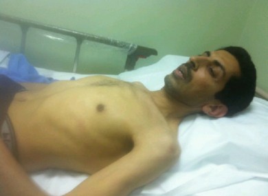 Abdulhadi Al Khawaja on day 57 of his hunger strike