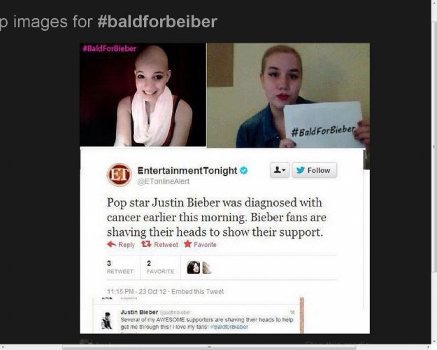 baldforbeiber
