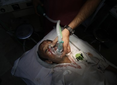 9-year-old Akhtar Yar undergoes surgery in Pakistan after he was injured in an acid attack