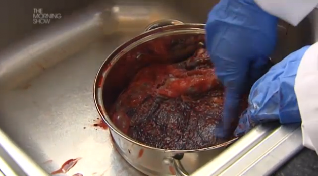 placenta2